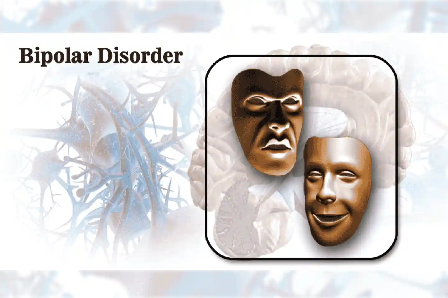 Bipolar Disorder